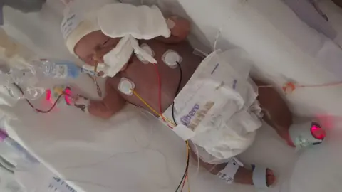 Family handout Image of Sunny wearing a knitted hat and nappy, with tubes and various monitoring devices, in a hospital bed