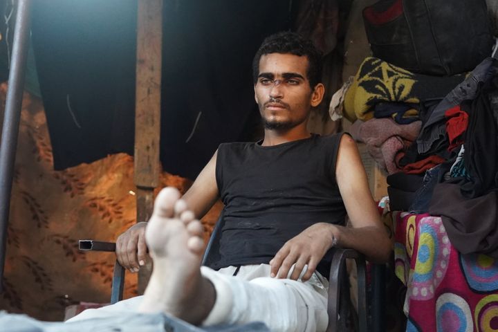 Palestinian man Fathi Abdulal, 21, rests in a tent following his release from an Israeli prison after 7 months in Deir al-Balah, Gaza on July 27, 2024. Abdulal, who was an electrical engineering student, suffers severe mental health issues and open wounds after he was subject to torture in prison.