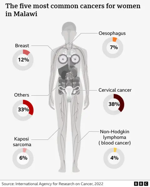 A diagram of a human body which shows the five most common cancers for women in Malawi. Cervical cancer is the most common, followed by breast, oesophagus, kaposi sarcoma and non-hodgkin lymphoma. 