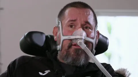 Nik Ward, who is wearing a tube to support his breathing over his nose