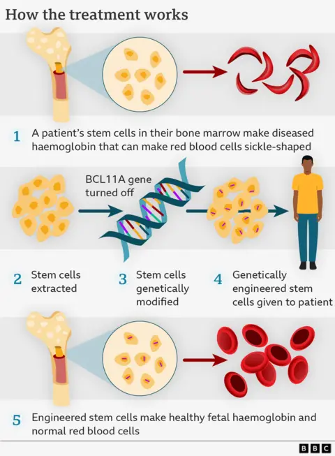 Graphic explaining how the treatment works in words and illustrations