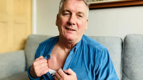 BBC Kevin Hill is sitting on his sofa and has opened his blue shirt to show a lump in his chest. This is where a small computer has been implanted. It is connected to wires that go deep into his brain, to control his Parkinson's disease. 